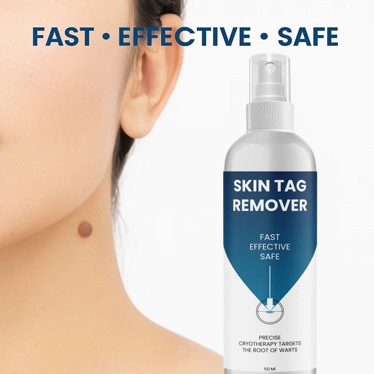 Powerful Skin Tag Removal Formula – 2 Bottles